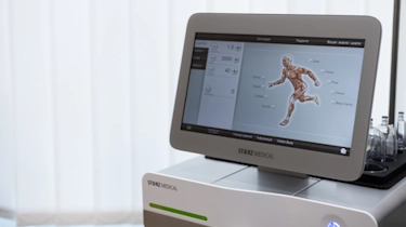Сучасний апарат Storz Medical для фокусованої ударно-хвильової терапії та радіальної ударно-хвильової терапії в Медонії Прайм